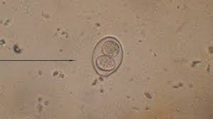 The Silent Threat: Coccidiosis in Kittens